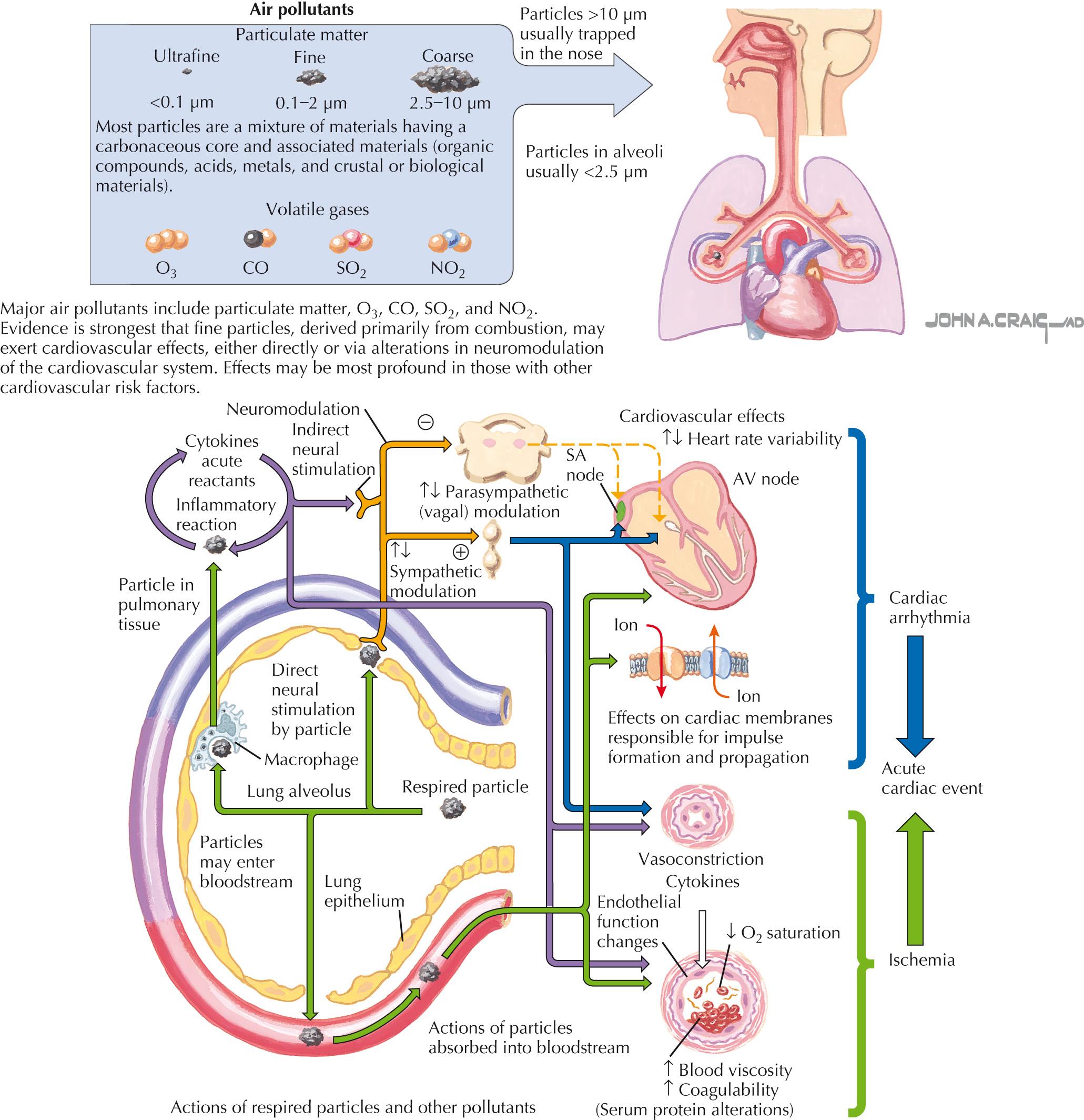 FIG 18.1, Cardiovascular Effects of Air Pollutants.