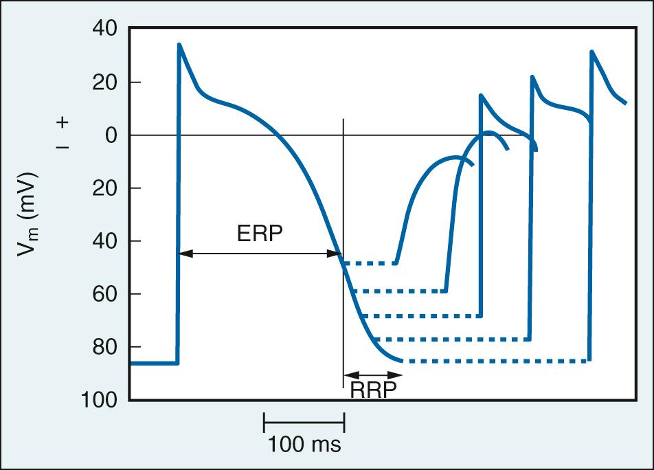 Fig. 23.2, Relationship between action potential amplitude and the point at which stimulation occurs within the previous action potential. As stimulation occurs after the end of the effective refractory period (ERP) and progressively later in the relative refractory period (RRP), action potential amplitude increases.