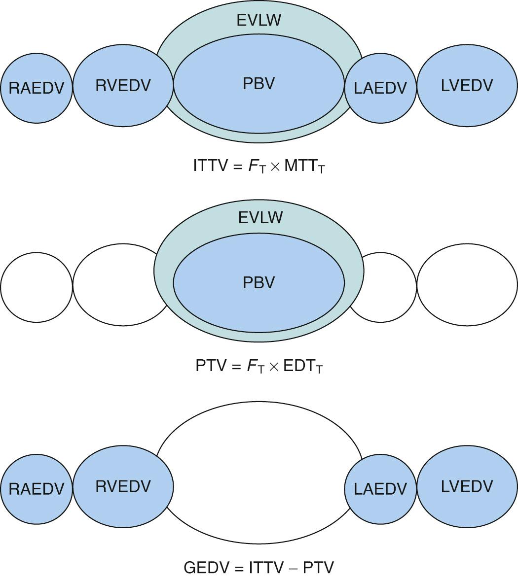 Fig. 24.7, The transpulmonary thermodilution method to calculate global end-diastolic volume (GEDV) and extravascular lung water (EVLW). Upper row: The intrathoracic thermal volume (ITTV) is the complete volume of distribution of the thermal indicator, encompassing the right atrium (RAEDV), right ventricle (RVEDV), left atrium (LAEDV), left ventricle end-diastolic (LVEDV) volumes, the pulmonary blood volume (PBV), and EVLW. It is calculated by multiplying cardiac output (F T ) with the mean transit time (MTT) of the indicator. Middle row: The pulmonary thermal volume (PTV) is the largest mixing chamber of the system and it includes the PBV and the EVLW. It is calculated by multiplying the F T with the exponential decay time (EDT) of the indicator. Bottom row: GEDV is the difference between ITTV and PTV. Intrathoracic blood volume (ITBV) is calculated by multiplying GEDV × 1.25. EVLW is calculated by subtracting ITBV from ITTV.