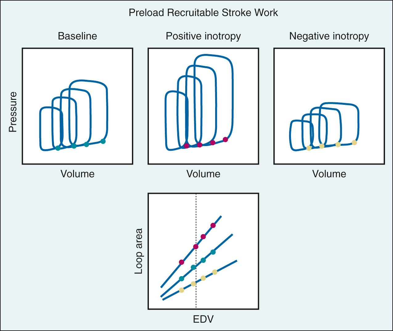 Fig. 24.8, Use of the preload recruitable stroke work to assess the inotropic state of the ventricle. Vena caval occlusion causes a progressive reduction in ventricular end-diastolic volume. The area of the pressure-volume loop is plotted for each beat as a function of the end-diastolic volume. The slope of this relationship defines how much work the ventricle can perform for a given preload and is a reflection of contractility—that is, a rise in the slope indicates increased contractility, and a fall in the slope indicates decreased contractility. EDV, End-diastolic volume.