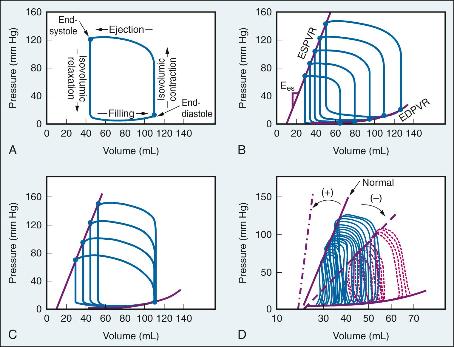 Fig. 24.9, A, Pressure-volume loop of the left ventricle. B, Multiple pressure-volume loops generated by progressive reductions in preload. C, Multiple pressure-volume loops generated by progressive increases in afterload. D, Use of pressure-volume loops to provide a load-dependent index of myocardial contractility. An increase in end-systolic elastance (Ees) indicates an increase in the slope of end-systolic pressure-volume relationship (ESPVR) and an increase in myocardial contractility (positive inotropy), whereas a decrease in Ees indicates a decrease in the slope of ESPVR (red loops) and a decrease in myocardial contractility (negative inotropy) compared with normal (blue loops) . EDPVR, End-diastolic pressure-volume relationship; ESPVR, end-systolic pressure-volume relationship.