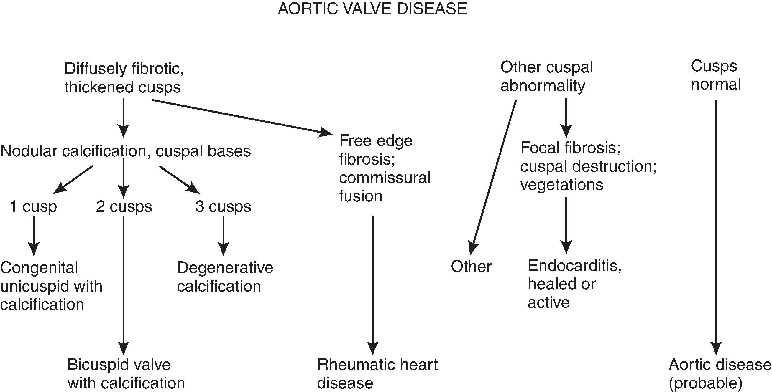 Figure 13.2, Overview of major diagnostic considerations in aortic valve disease. (From Schoen FJ: Evaluation of surgically removed natural and prosthetic heart valves. In Virmani R, Fenoglio JJ, eds. Cardiovascular Pathology. Philadelphia: W.B. Saunders, 1991:404.)