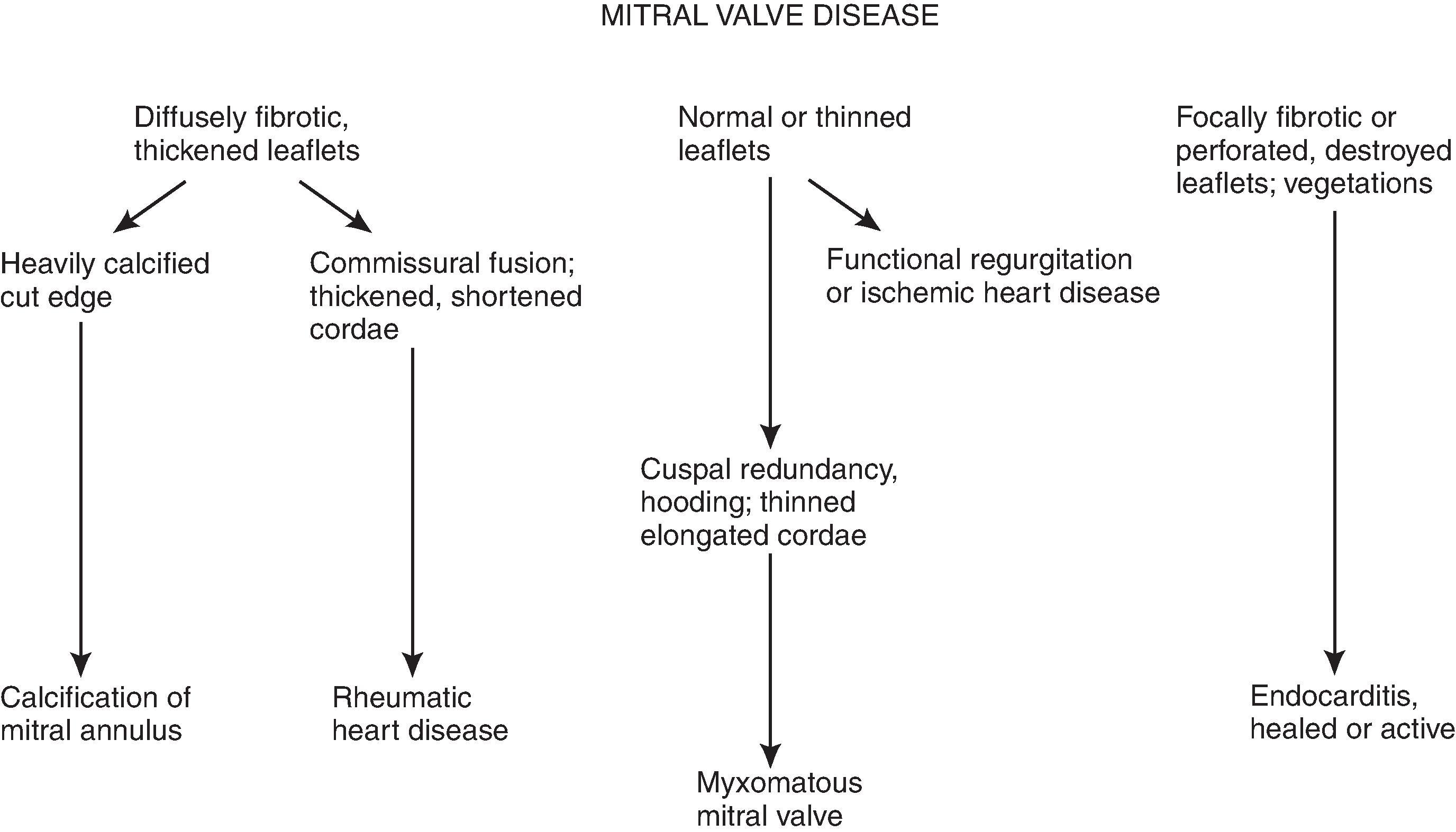 Figure 13.3, Overview of major diagnostic considerations in mitral valve disease. (From Schoen FJ. Evaluation of surgically removed natural and prosthetic heart valves. In: Virmani R, Fenoglio JJ, eds. Cardiovascular Pathology. Philadelphia: W.B. Saunders; 1991:404.)