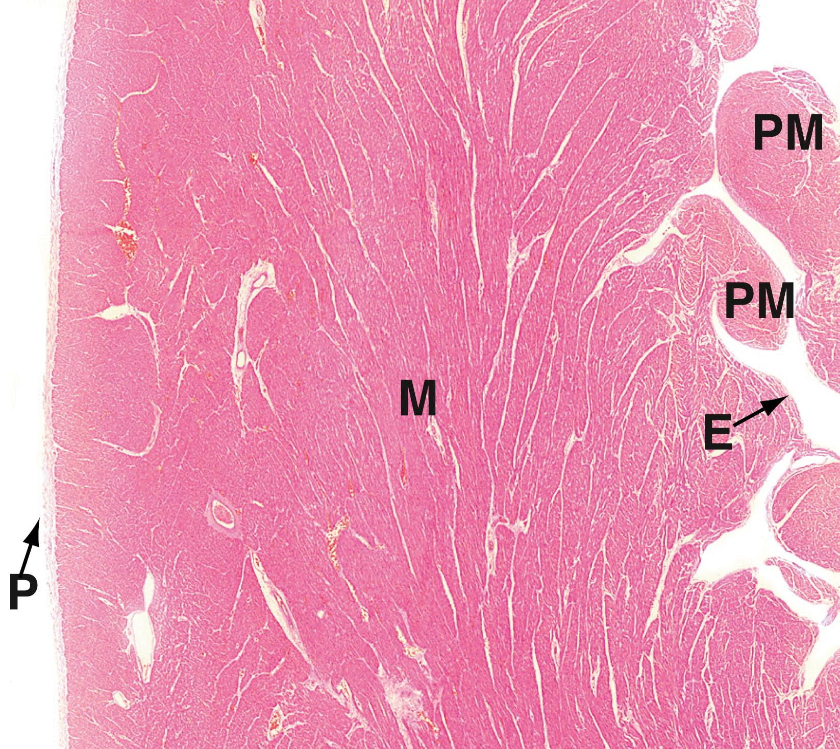E-Fig. 11.5 H, Heart: left ventricular wall H&E (LP). This low-power micrograph shows the three basic layers of the heart wall, in this case the left ventricle . The tunica intima equivalent of the heart is the endocardium E , normally a thin layer in a ventricle. This is lined by a single layer of flattened endothelial cells, as is the case elsewhere in the circulatory system. The tunica media equivalent is the myocardium M , made up of cardiac-type muscle. In the left ventricle, this layer is very prominent due to its role in pumping oxygenated blood throughout the systemic circulation, but it is less thick in the right ventricle and in the atria which operate at much lower pressures. Note the origins of the papillary muscles PM , extensions of the myocardium which protrude into the left ventricular cavity and provide attachment points of the chordae tendinae which tether the cusps of the atrio-ventricular valves. The equivalent of the tunica adventitia is the epicardium or visceral pericardium P , usually a thin layer (as here) but, in some areas, containing adipose tissue. The coronary arteries run within the epicardial fat.