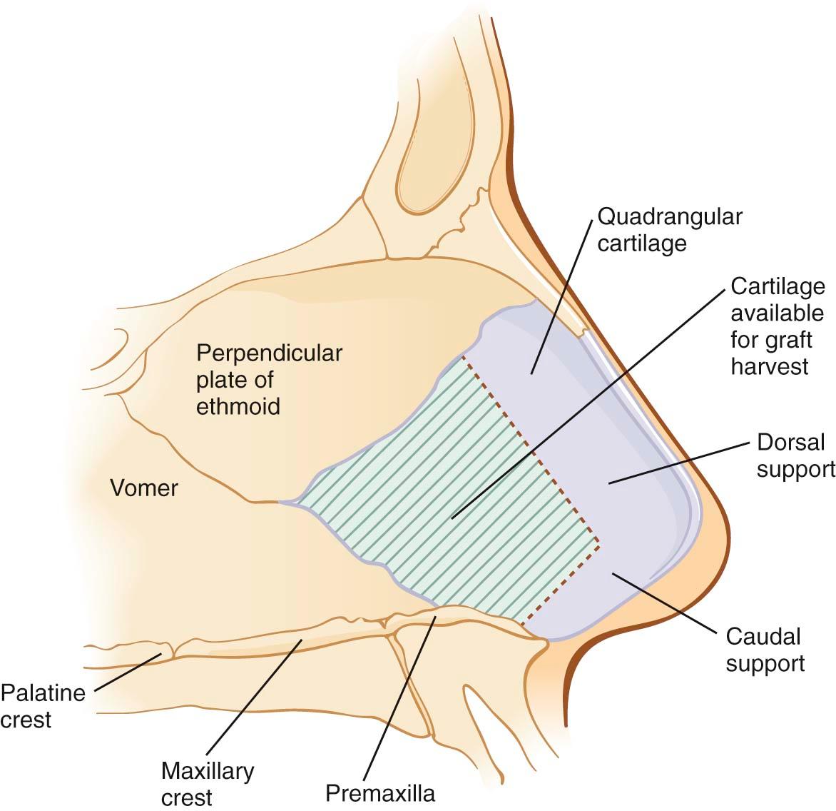 Figure 11-2, Nasal septal anatomy. The shaded area can be safely harvested for grafts.