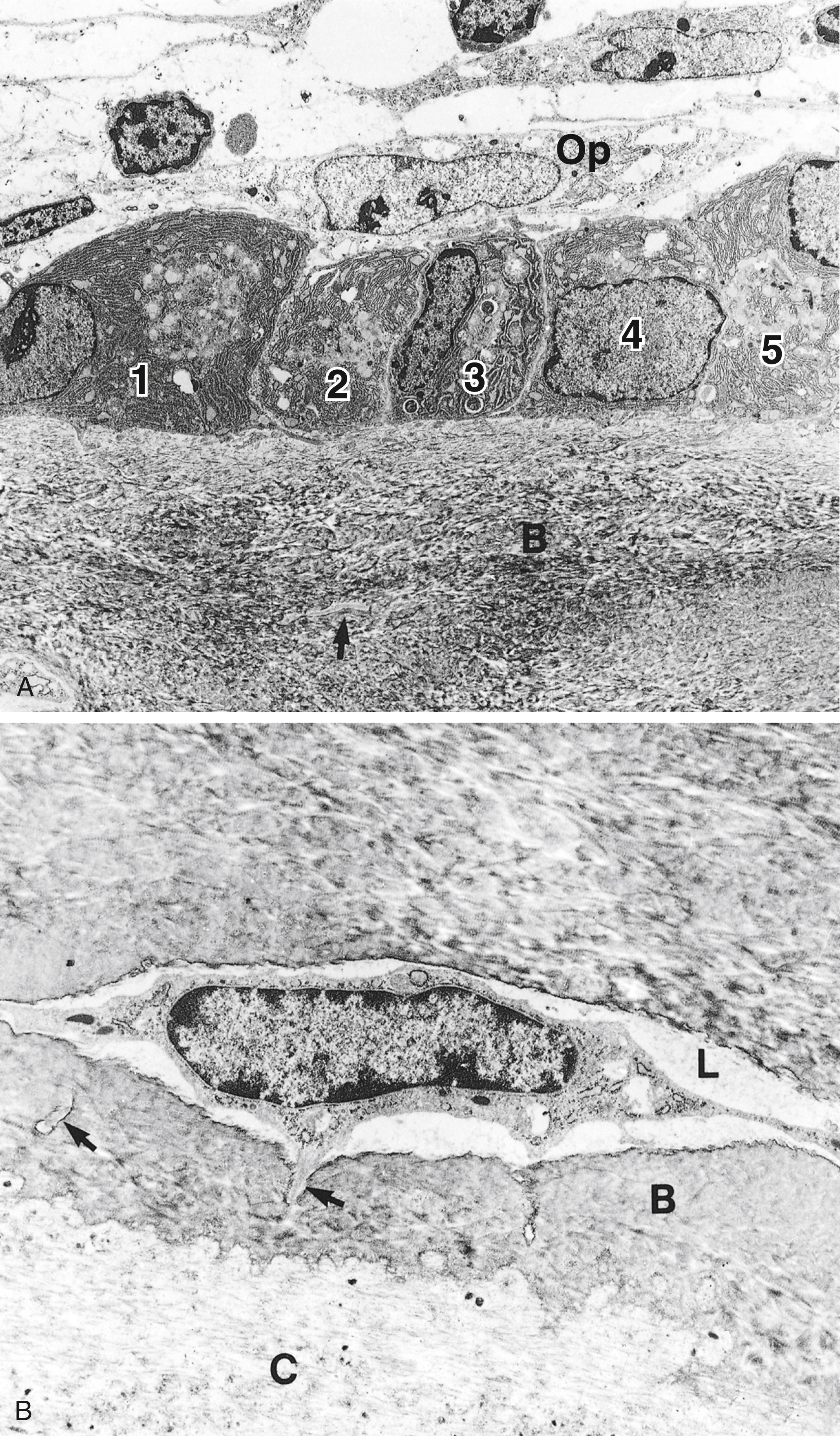 Fig. 7.11, Electron micrograph of bone-forming cells. (A) Observe the five osteoblasts (numbered 1 to 5) lined up on the surface of bone (B) displaying abundant rough endoplasmic reticulum. The arrow indicates the process of an osteocyte in a canaliculus. The cell with the elongated nucleus lying above the osteoblasts is an osteoprogenitor cell (op) (×2500). (B) Note the osteocyte in its lacuna (L) with its processes extending into canaliculi (×1000). B, bone; C, cartilage.