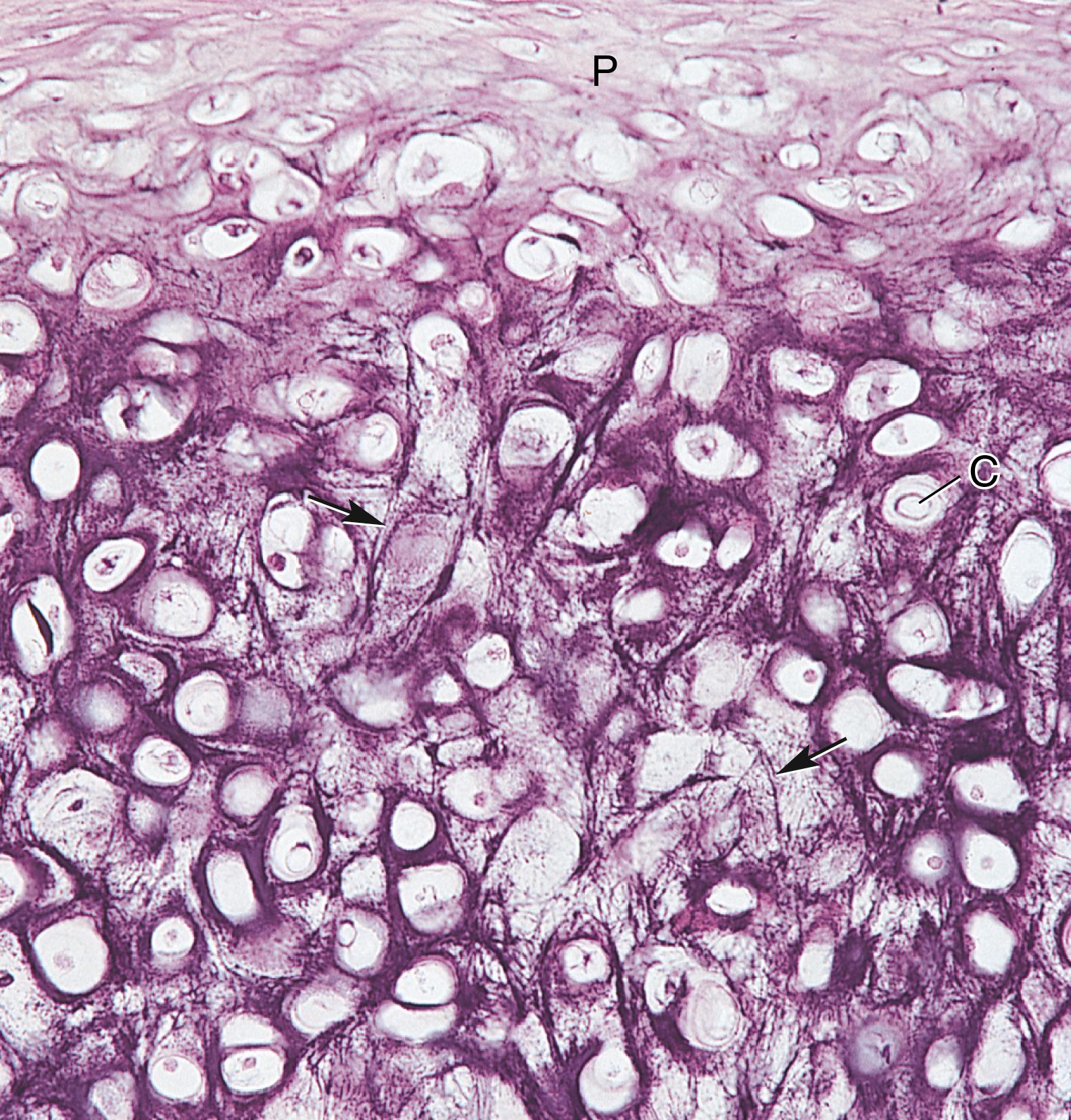 Fig. 7.5, Light micrograph of elastic cartilage (×132). Observe the perichondrium (P) and the chondrocytes (C) in their lacunae (shrunken from the walls because of processing), some of which contain more than one cell, evidence of interstitial growth. Elastic fibers (arrows) are scattered throughout.