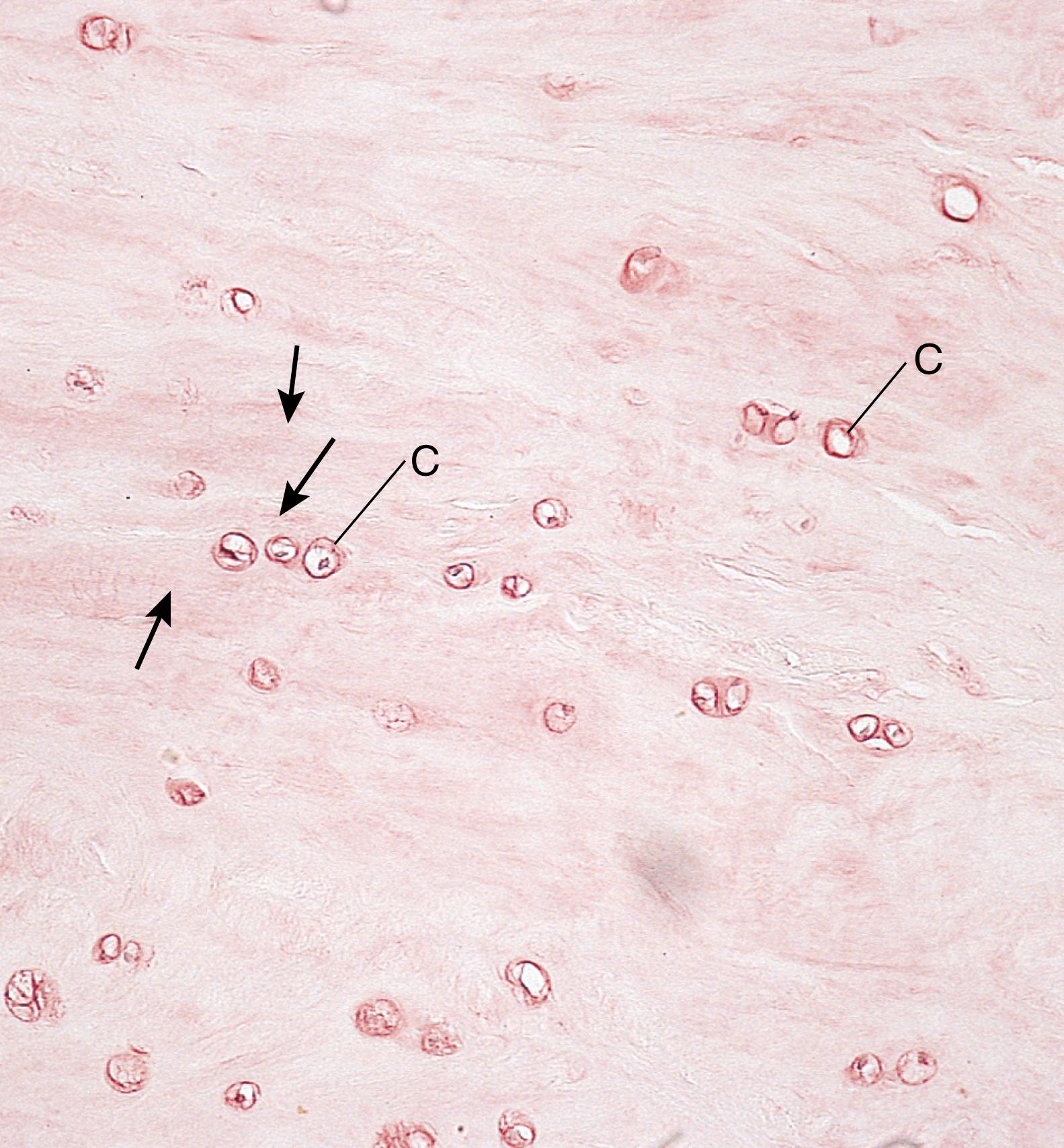 Fig. 7.7, Light micrograph of fibrocartilage (×132). Note alignment of the chondrocytes (C) in rows interspersed with thick bundles of collagen fibers (arrows) .