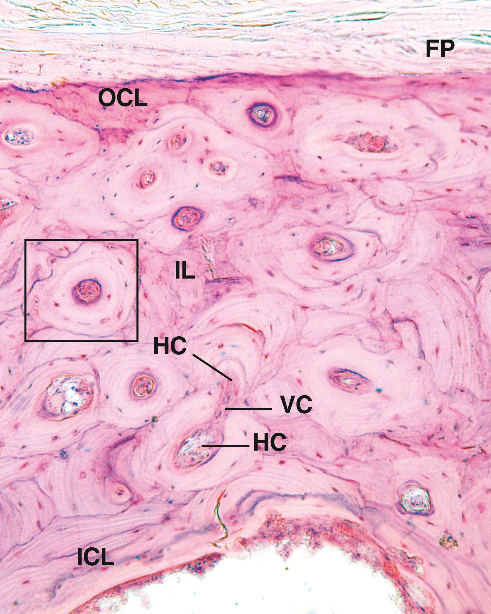 Fig. 7.8, This is a low-magnification cross-section of a decalcified human rib. Observe that the four lamellar systems are clearly evident: the outer circumferential lamellae (OCL) just deep to the periosteum (FP); the inner circumferential lamellae (ICL), encircling the marrow cavity; the numerous osteons, one of which is enclosed by the box; and the interstitial lamellae (IL) interposed among the osteons. Each osteon has its own haversian canal (HC) and haversian canals are interconnected by occasional Volkmann canals (VC).