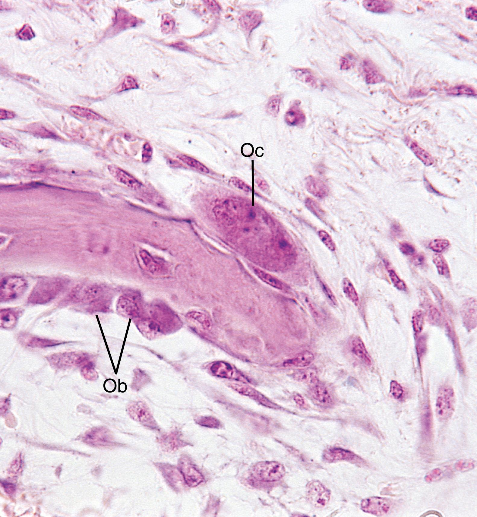 Fig. 7.10, Light micrograph of intramembranous ossification (×540). Osteoblasts (Ob) line the bony spicule, where they are secreting osteoid onto the bone. Osteoclasts (Oc) may be observed housed in a Howship lacuna.