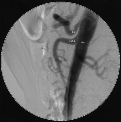 Fig. 15.4, Femoral Access.