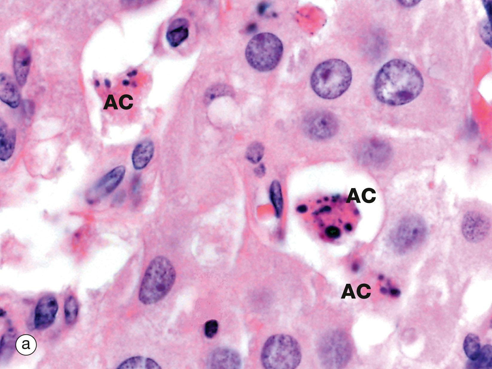 Fig. 2.7, Apoptosis in normal tissues