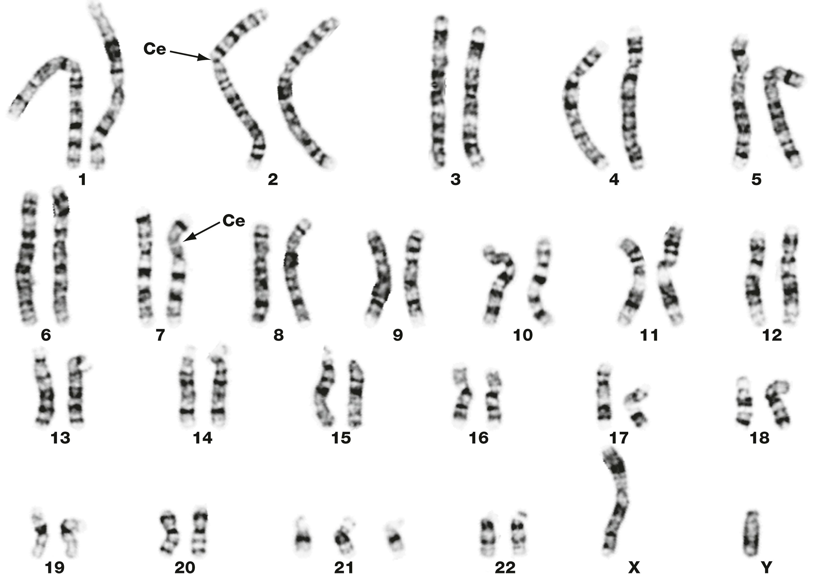 Fig. 2.5, Human karyotype