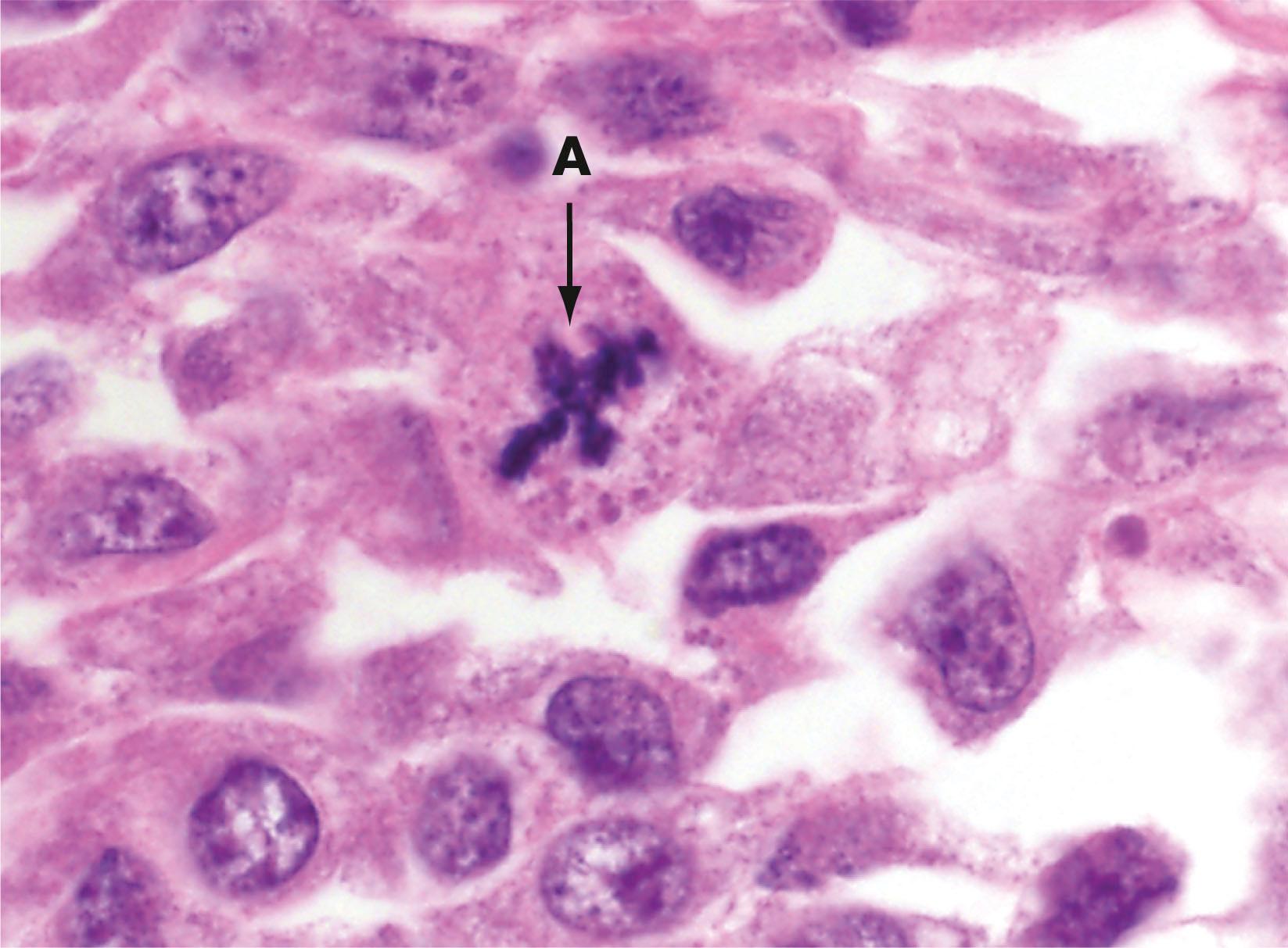 Fig. 2.9, Abnormal mitotic figure H&E (HP)