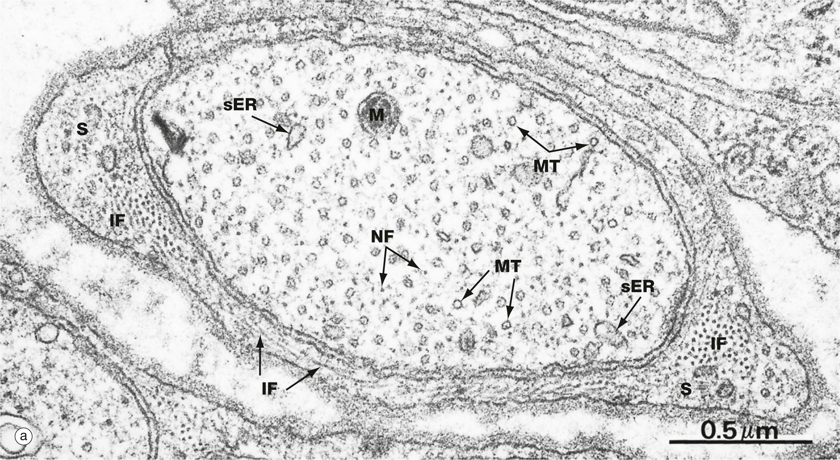 Fig. 1.17, Intermediate filaments and microtubules