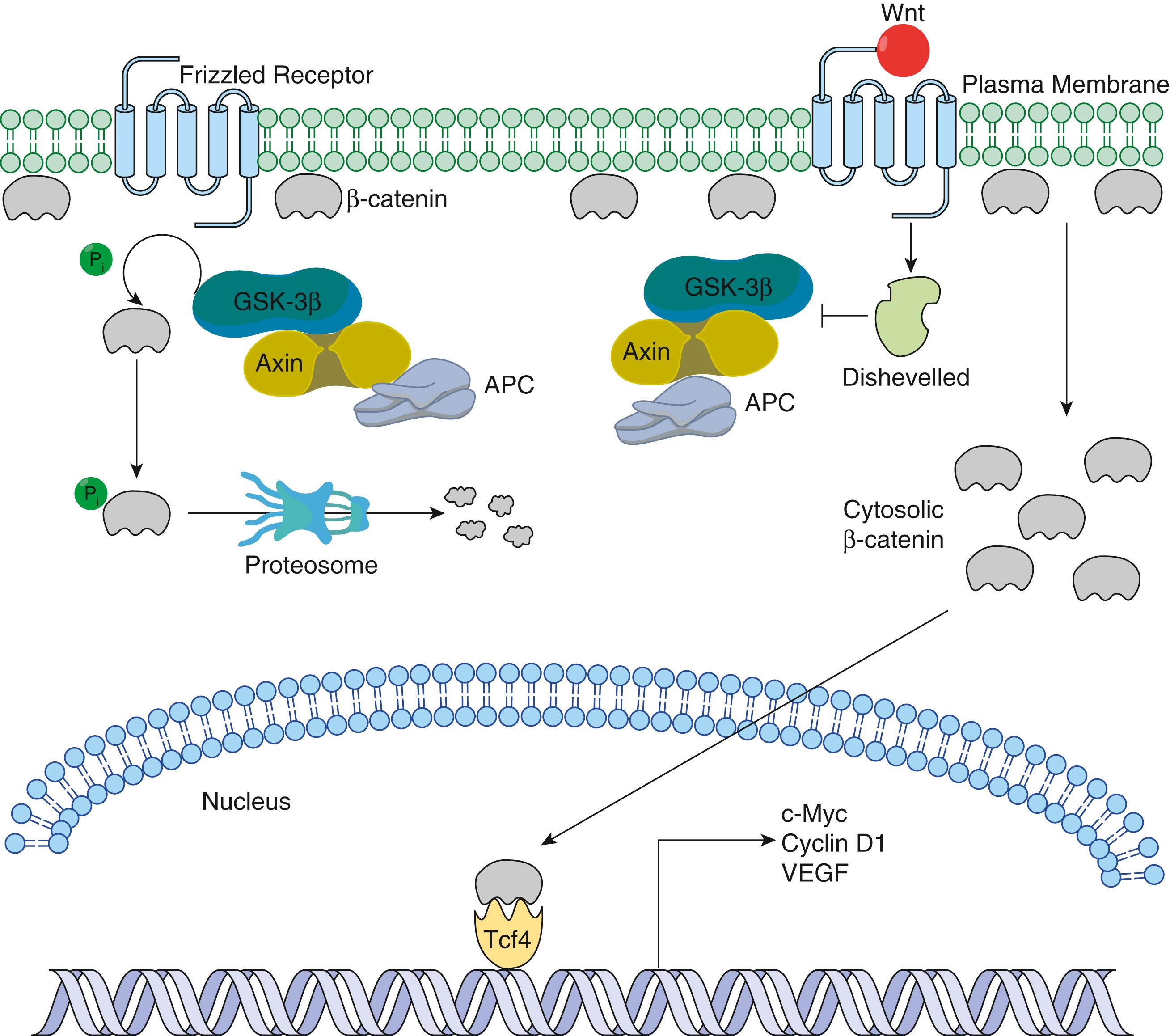 Fig. 1.3, The Wnt signaling pathway is an important regulator of intestinal epithelial cell proliferation and tumorigenesis. In the absence of a Wnt signal ( left top ), cytosolic β-catenin is regulated by the destruction complex, consisting of APC , Axin , and glycogen synthase kinase-3β ( GSK-3β ). The destruction complex phosphorylates α-catenin and targets it for degradation via the ubiquitin-proteosome pathway. In the presence of an active Wnt signal ( right top ), α-catenin degradation is prevented and the protein is stabilized, leading to excess cytoplasmic α-catenin which is translocated to the nucleus. Nuclear α-catenin interacts with the Tcf-4 transcription factor to regulate the expression of many key target genes. APC , Adenomatous polyposis coli; P , phosphate group; Ub , ubiquitin; VEGF , vascular endothelial growth factor.