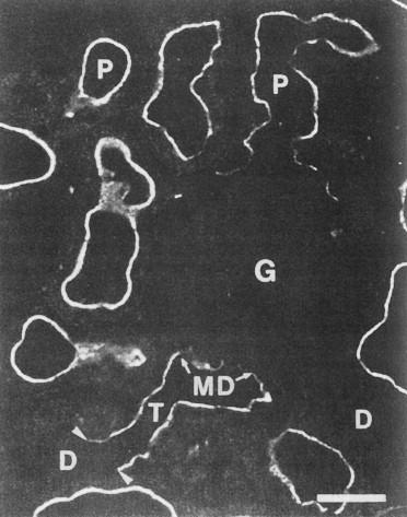 Figure 55.2, Immunohistochemical localization of NHE3 in rat kidney cortex. NHE3 is expressed on the apical membrane of the proximal tubule ( P ) and thick ascending limb ( T ), but is not expressed in the distal convoluted tubule ( D ) or glomerulus ( G ).