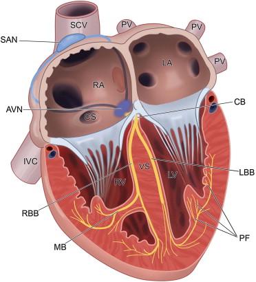 FIGURE 7.1, Organization of the human cardiac conduction system. The sinoatrial node (SAN), generally positioned near the confluence of the superior caval vein (SCV) and the right atrium (RA), is the primary cardiac pacemaker. An electrical impulse generated by the SAN is conducted across the atria to the atrioventricular node (AVN), to the bundle of His (CB), and the left and right bundle branches (LBB, RBB). Finally, cardiac Purkinje fibers (PF) transmit the cardiac action potential throughout the myocardium. CS, coronary sinus; IVC, inferior vena cava; MB, moderator band; LV, RV, left and right ventricle; LA, RA, left and right atrium; PV, pulmonary vein; VS, ventricular septum.