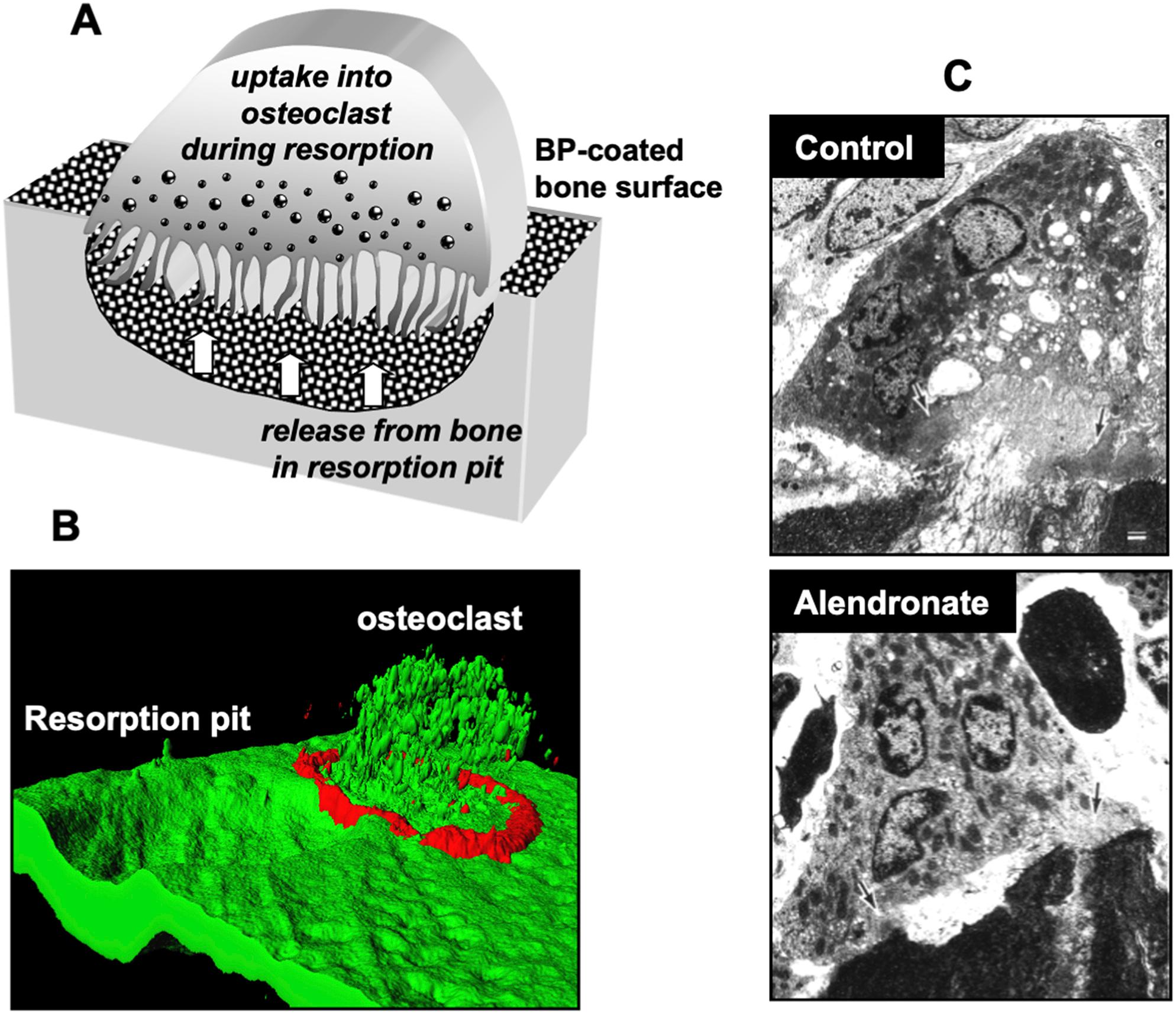 Figure 62.2, Cellular uptake of BPs by osteoclasts.