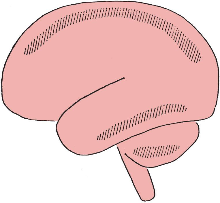 Fig. 31.1, Hatched areas showing the most frequent locations of boundary area, or watershed zone infarcts in the brain, situated between the territories of major cerebral or cerebellar arteries.