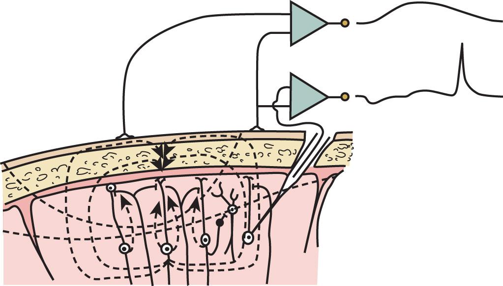 Fig. 12.1, Production of electroencephalographic (EEG) waves. Scalp electrodes record potential differences that are caused by postsynaptic potentials in the cell membrane of cortical neurons. The closed loop dashed lines represent the summation of extracellular currents produced by the postsynaptic potentials. Open segment dashed lines connect all points having the same voltage level. The two scalp electrodes record changes in the voltage difference over time (top trace at upper right). The lower trace from a microelectrode inserted in a single cortical neuron has little direct relationship with the summated EEG wave.