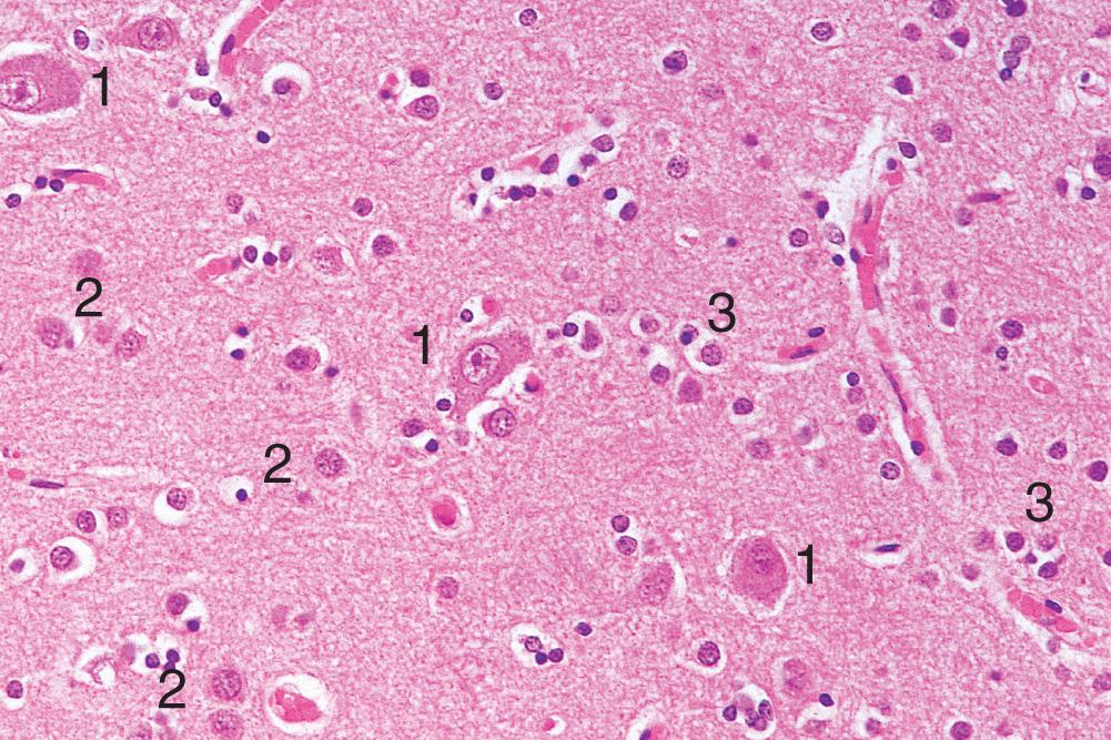 Fig. 26.3, Normal cerebral cortex.