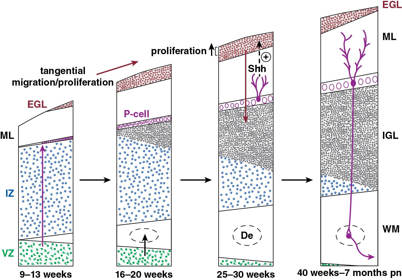 Fig. 5.3, Major events in the histogenesis of the cerebellum in four major time periods from 9 weeks of gestation to 7 months postnatal (pn). The two zones of proliferation are the ventricular zone (VZ) and the external granule cell layer (EGL). Three directions of migration are indicated by arrows, that is, radial from the VZ, tangential over the surface of the cerebellum to form the EGL, and later, inward to form the internal granular layer (IGL). Proliferation in the outer half of the EGL is under positive control by Sonic hedgehog (Shh) secreted by Purkinje cells (P-cells). Note the markedly active proliferation and migration of the granule precursor cells of the EGL during the premature period. Not shown is the marked increase in size of the molecular layer (ML) during the postnatal period. De , dentate; IZ , intermediate zone; pn , postnatal; WM , white matter.