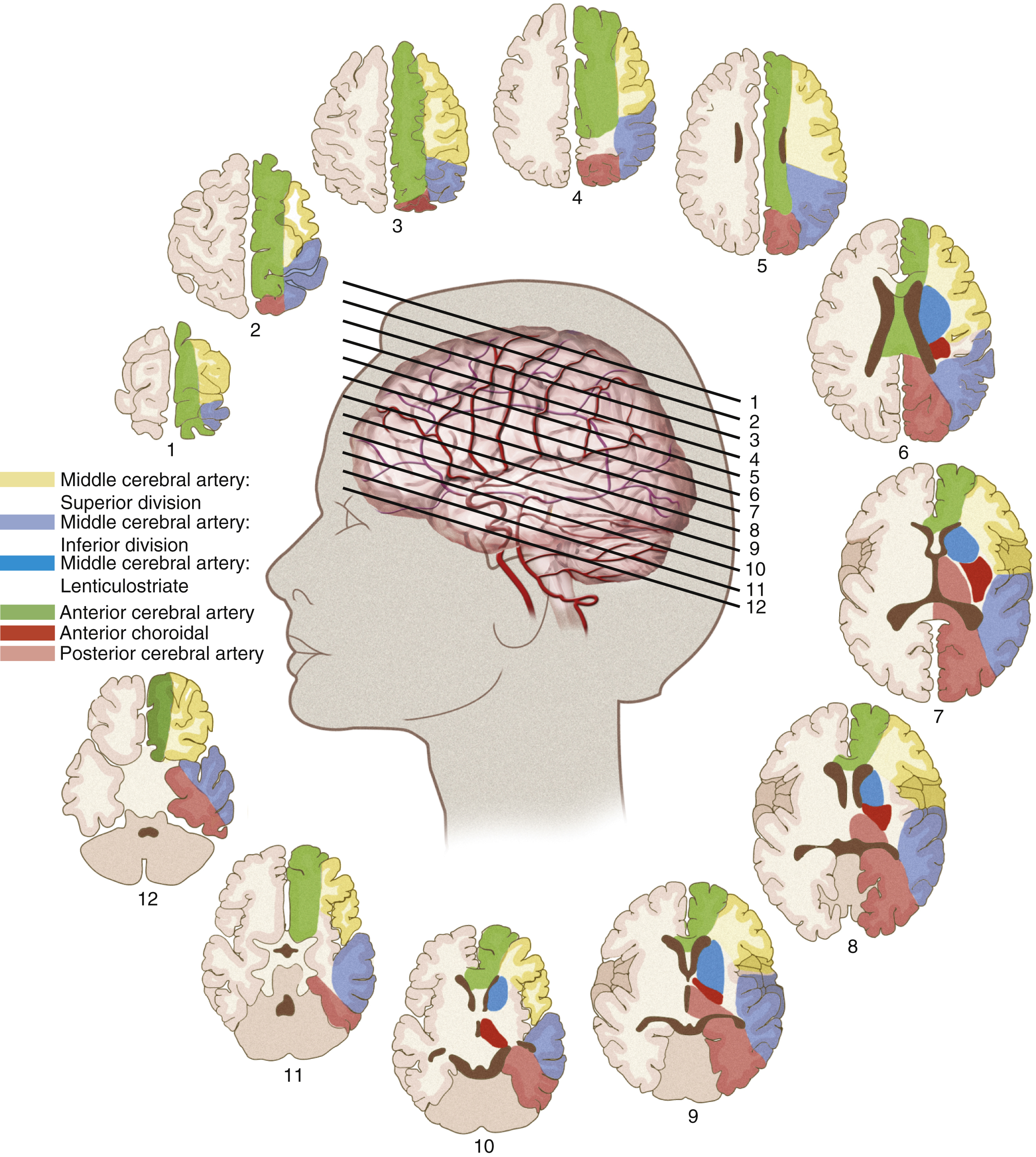 Fig. 59.2, Vascular anatomy related to areas of brain. Occlusion of named arteries will present as complete or incomplete strokes in these vascular distributions.