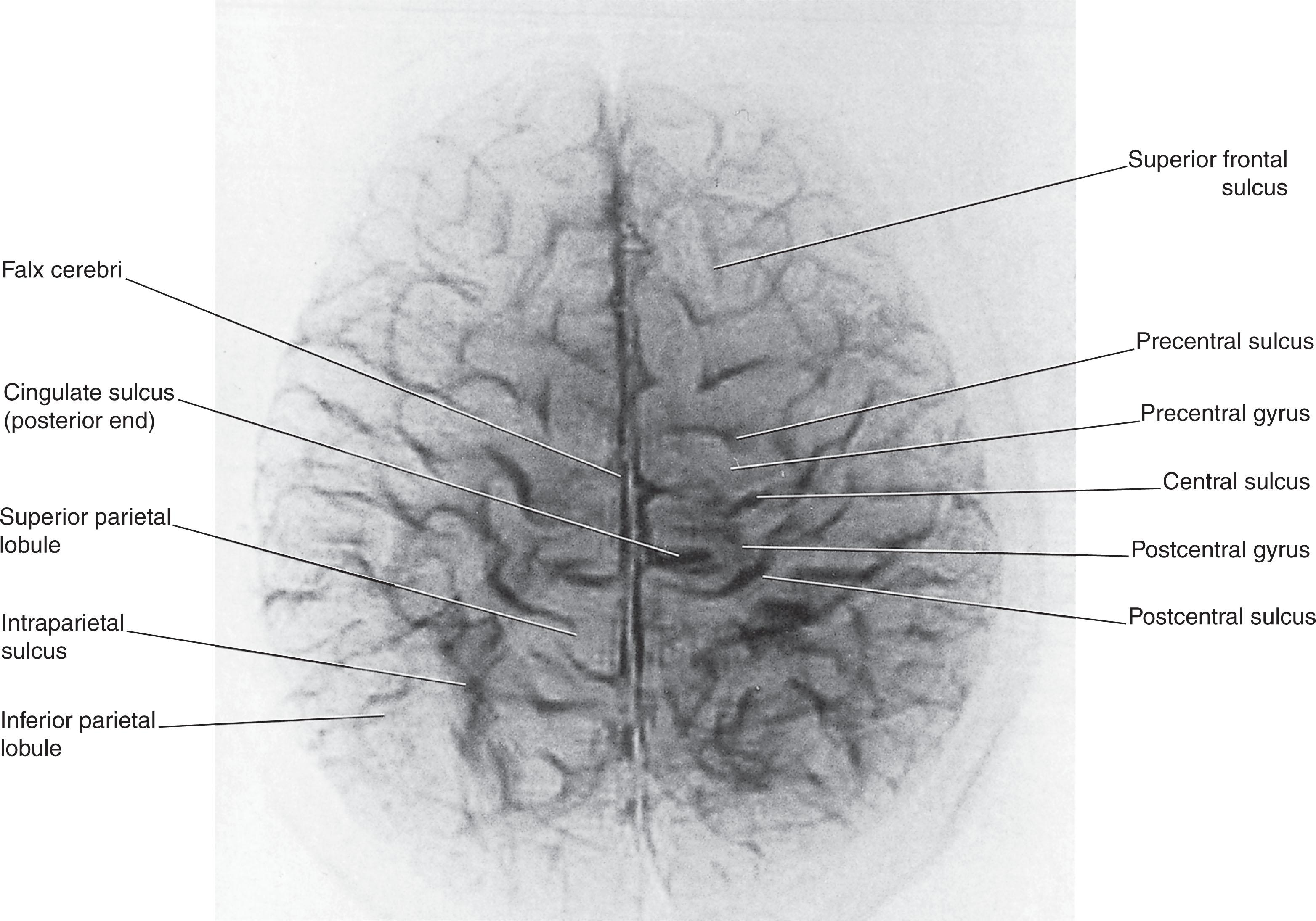 Fig. 2.4, ‘Thick slice’ surface anatomy brain Magnetic Resonance Imaging scan from a healthy volunteer.