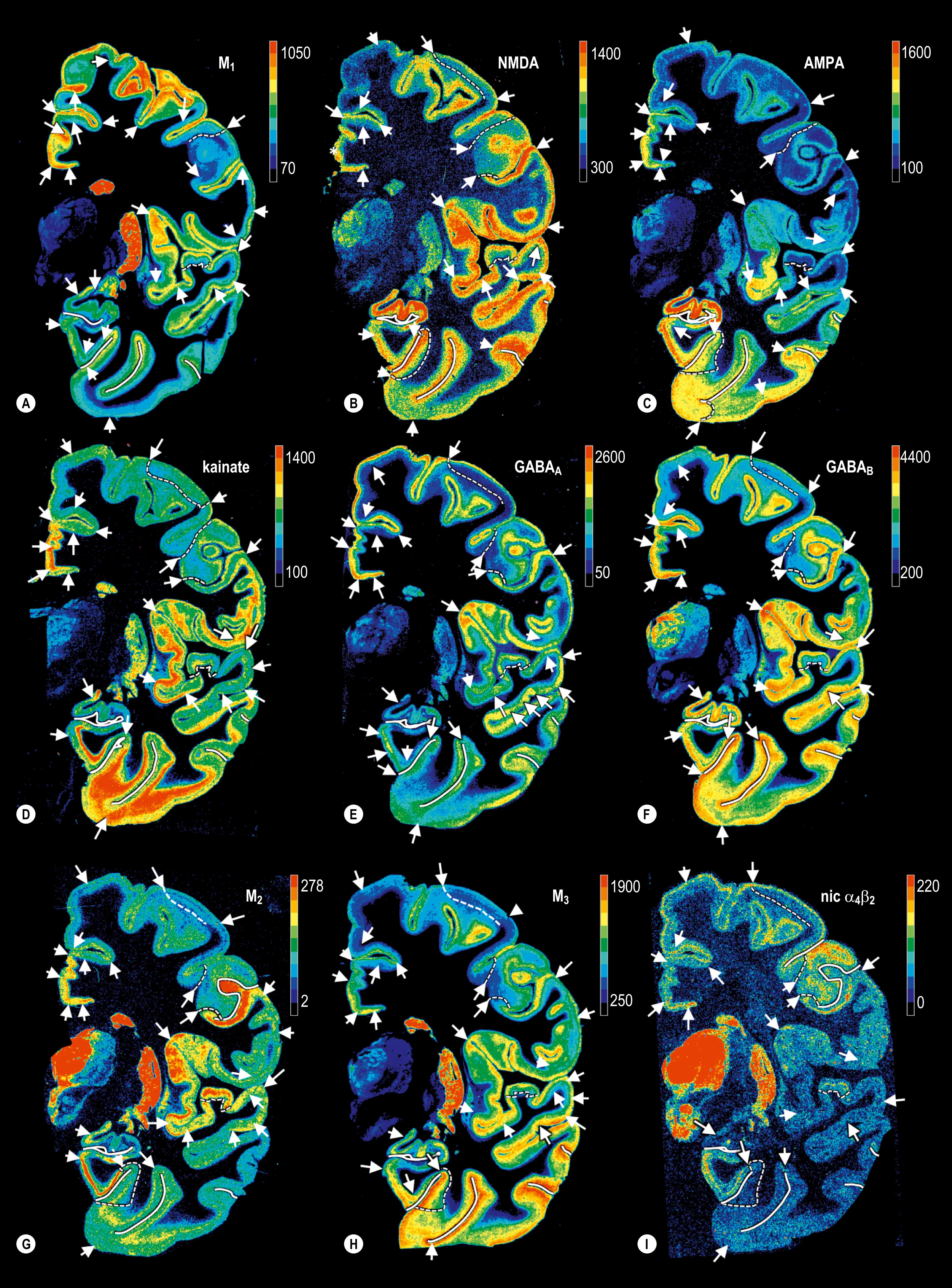 Fig. 32.29, A–R , Regional and laminar distribution of various neurotransmitter receptors of the human brain visualized with colour-coded quantitative receptor autoradiography. Each image, obtained from nine contiguous coronal slices at the level of the central sulcus, shows the distribution of the following receptors: A , Acetylcholine muscarinic M 1 receptor; B , glutamate NMDA receptor; C , glutamate AMPA receptor; D , glutamate kainate receptor; E , GABA A receptor; F , GABA B receptor; G , acetylcholine muscarinic M 2 receptor; H , acetylcholine muscarinic M3 receptor; I , acetylcholine nicotinic α 4 β 2 receptor; J , noradrenaline α 1 receptor; K , noradrenaline α2 receptor; L , serotonin 5-HT 1 A receptor; M , dopamine D 1 receptor; N , glutamate metabotropic mGluR2/3 receptor; O , serotonin 5-HT 2 receptor; P , adenosine A 1 receptor; Q , map of the respective cortical areas; R , myelin-stained alternate section. Key and abbreviations: 1, area 1 (part of primary somatosensory cortex); 2, area 2 (part of primary somatosensory cortex); 3a, area 3a (part of primary somatosensory cortex); 3b, area 3b (part of primary somatosensory cortex); 4a, area 4a (part of primary motor cortex); 4p, area 4p (part of primary motor cortex); 6, area 6 (lateral premotor cortex); 23c, area 23c (posterior cingulate cortex); 23d, area 23d (posterior cingulate cortex); 24dd, area 24dd (midcingulate cortex); 24dv, area 24dv (midcingulate cortex); 33, area 33 (cingulate cortex); 35, area 35 (perirhinal cortex); 36, area 36 (ectorhinal cortex); a, amygdala; c, central sulcus; cd, caudate nucleus; ci, cingulate sulcus; cl, claustrum; co, colateral sulcus; ec, entorhinal cortex; gp, globus pallidus; h, hippocampal formation; HATA, hippocampo-amygdaloid transition area; ins, insula; it, inferior temporal sulcus; lf, lateral fissure; occt, occipito-temporal sulcus; p24a′, area p24a′; p24b′, area p24b′; poc, postcentral cortex; prc, precentral sulcus; pu, putamen; r, nucleus ruber; S II, secondary somatosensory cortex (parietal opercular cortex); SMA, supplementary motor cortex; sn, substantia nigra; st, superior temporal sulcus; unc, uncinate sulcus; Te1, area Te1 (primary auditory cortex); Te2.1, area Te2.1 (secondary auditory cortex); Te2.2, area Te2.2 (secondary auditory cortex); Te2.3, area Te2.3 (secondary auditory cortex); Te3.1, area Te3.1; Te3.2, area Te3.2; TI, temporo-insular area; TPO, temporo-parieto-occipital cortex; trans, transentorhinal area. Arrows label boundaries of cortical areas. Colour scales indicate densities of receptors in fmol/mg protein.