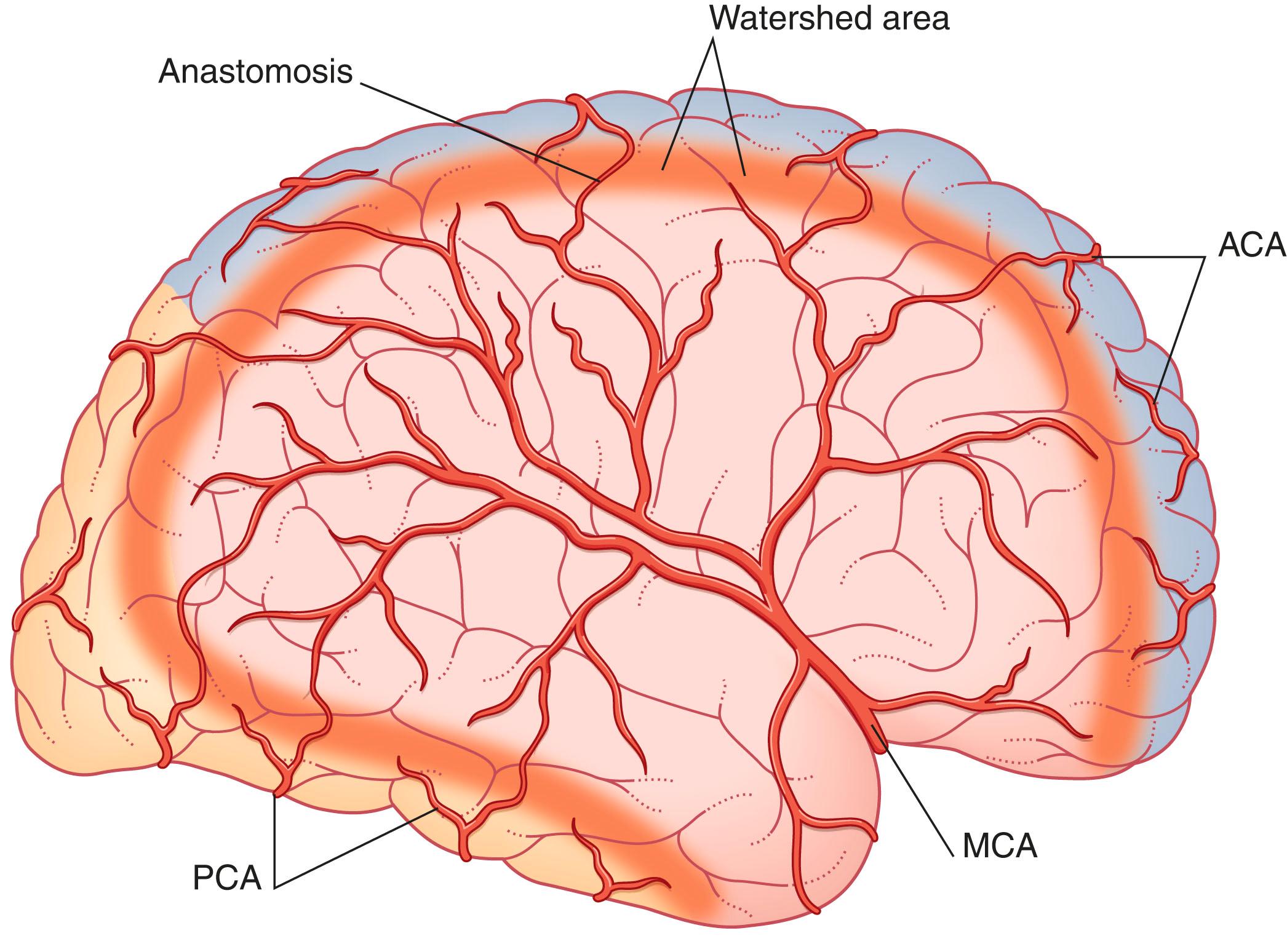 Fig. 35.1, Watershed area of anastomotic overlap between the middle cerebral artery (MCA) and the anterior and posterior cerebral arteries (ACA , PCA) .