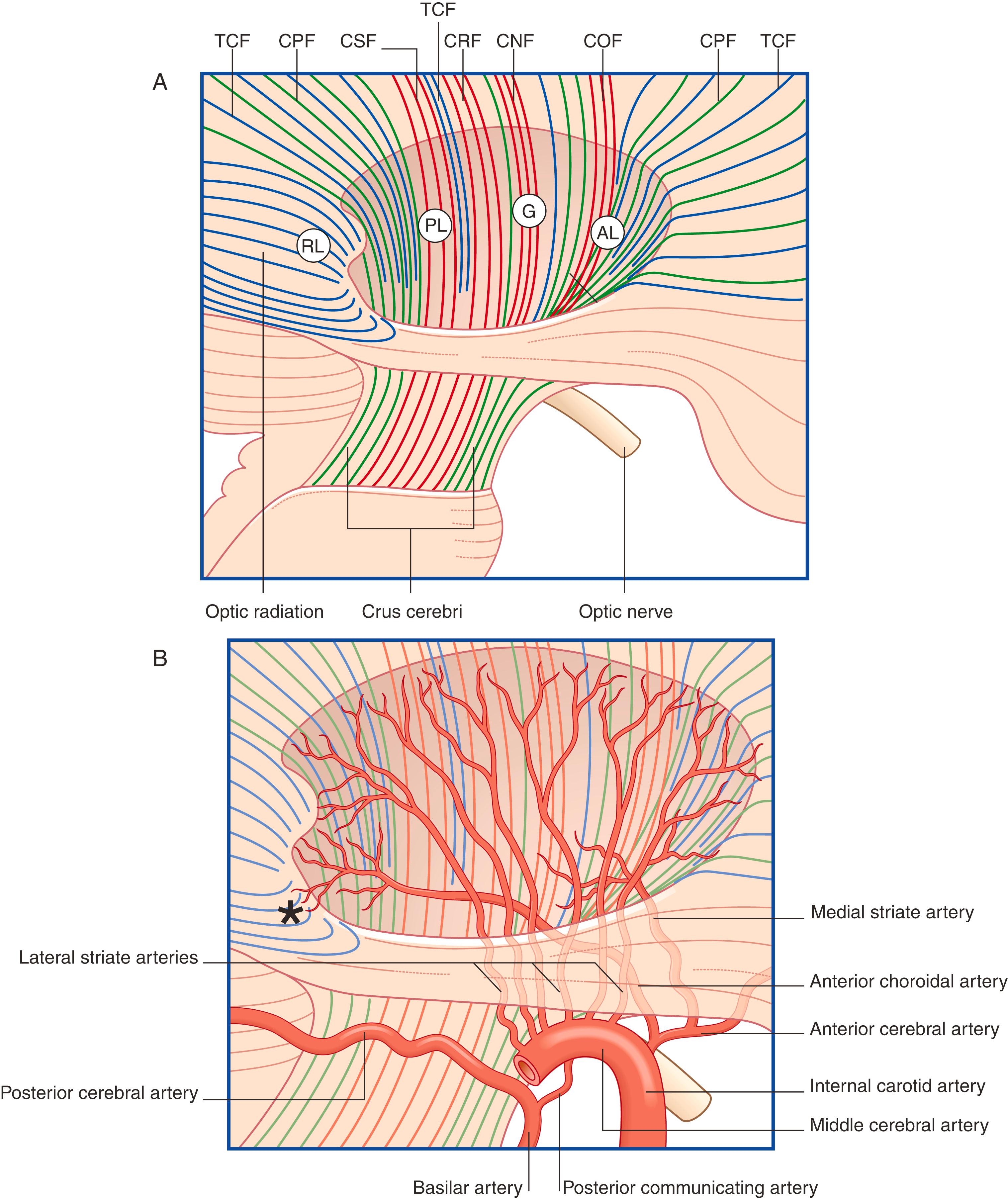 Fig. 35.3, Internal capsule. (A) Pathways. Lateral view of the right cerebral hemisphere showing the oval depression in the white matter following removal of the lentiform nucleus. The internal capsule occupies the floor of the depression. (B) Blood supply. The medial striate branch of the anterior cerebral artery is the recurrent artery of Heubner . Only three of the six lateral striate branches of the middle cerebral artery shown are labelled. *Arterial supply from the anterior choroidal artery to the inferolateral part of the lateral geniculate body. AL , Anterior limb; CNF , corticonuclear fibres; COF , corticooculomotor fibres; CPF , corticopontine fibres; CRF , corticoreticular fibres; CSF , corticospinal fibres; G , genu; IC , internal capsule; LGB , lateral geniculate body; PL , posterior limb; RL , retrolenticular; SC , superior colliculus; TCF , thalamocortical fibres.