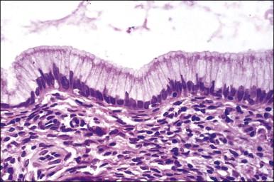 Figure 8.12, Normal endocervical epithelium. The cells are columnar, contain mucin, and the nuclei are basally located.