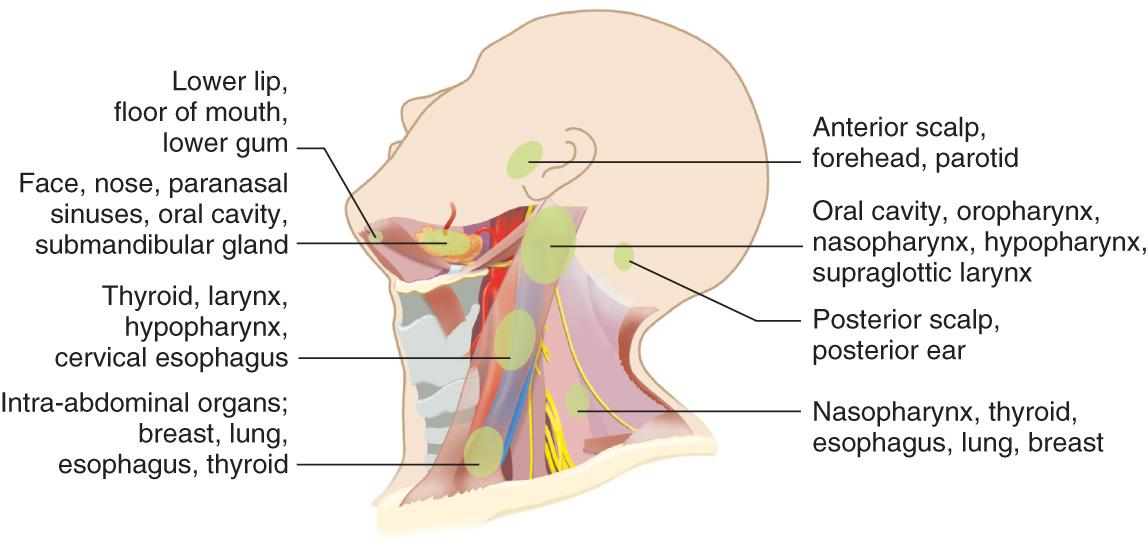 Figure 11.4, The regional lymph node groups draining a specific primary site as first-echelon lymph nodes.