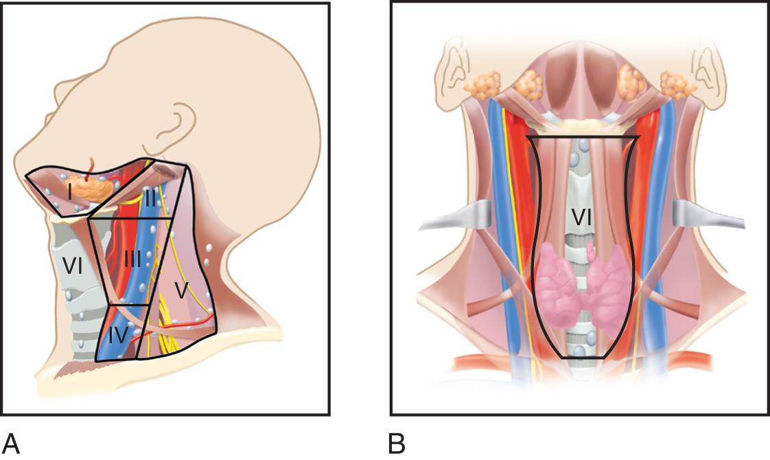 Figure 11.5, The Memorial Sloan Kettering Cancer Center system of assigning levels to cervical lymph nodes. A , The lateral side of the neck. B , The central compartment and superior mediastinum.