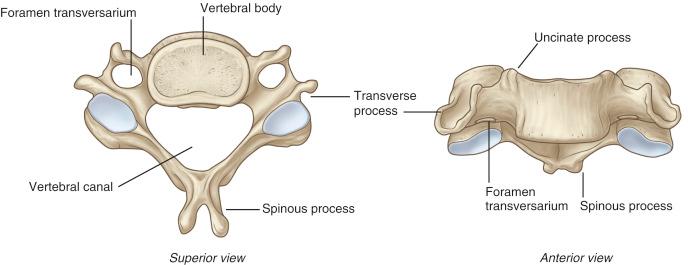 FIGURE 1-4, Typical cervical vertebra.