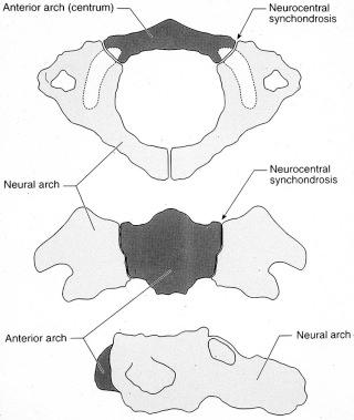 eFIGURE 4–1, Atlas ossification centers and synchondroses.