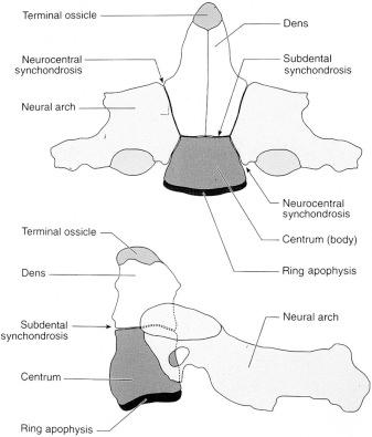 eFIGURE 4–2, Axis ossification centers and synchondroses.