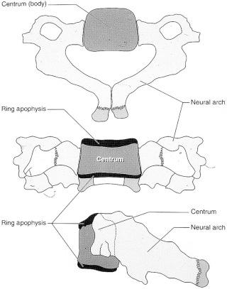 eFIGURE 4–3, Ossification centers of a typical cervical vertebra.