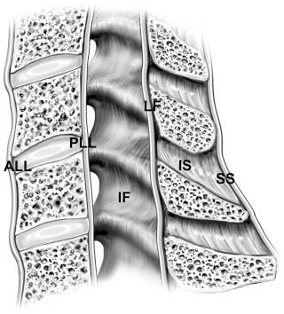 FIGURE 4–1, Cervical ligaments. ALL, Anterior longitudinal ligament; PLL, posterior longitudinal ligament; IF, interfacetal ligament; LF, ligamentum flavum; IS, interspinous ligament; SS, supraspinous ligament.