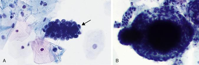 Fig. 1.12, Endometrial Cells.