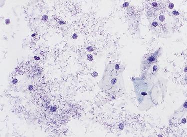 Fig. 1.18, Lactobacilli.