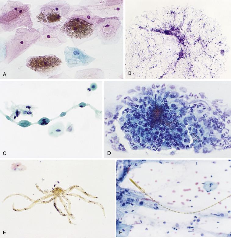 Fig. 1.19, Artifacts and Contaminants.