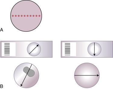 Fig. 1.3, Method for Estimating the Adequacy of the Squamous Component of Liquid-Based Preparations.