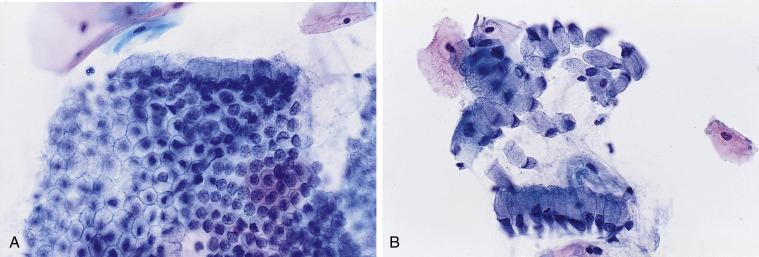 Fig. 1.10, Endocervical Cells.