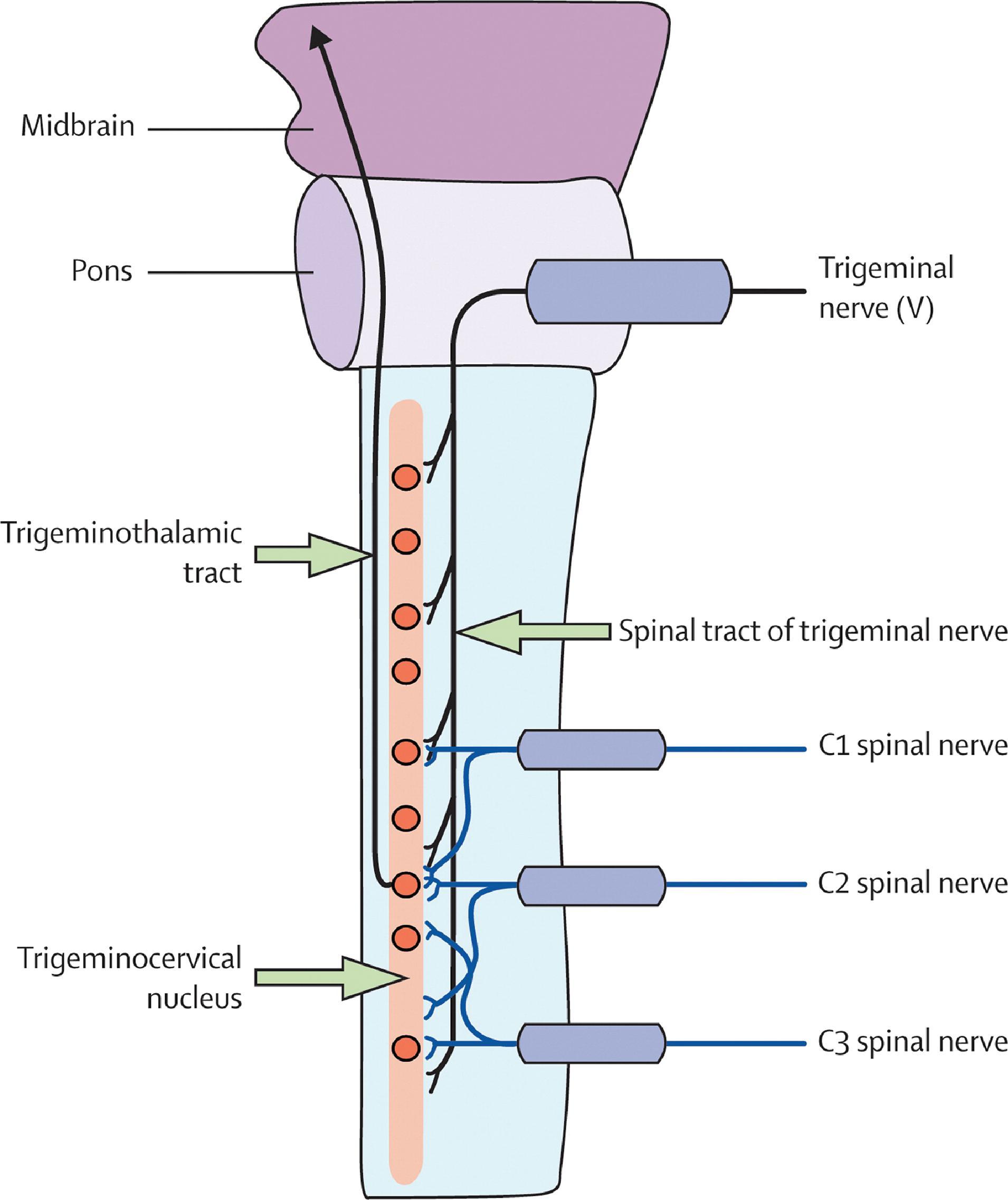 Figure 39.1, Nociceptive afferents of the trigeminal and upper three cervical spinal nerves converge onto second-order neurons in the trigeminocervical nucleus in the upper cervical spinal cord. This convergence mediates the referral of pain signals from the neck to regions of the head innervated by cervical nerves or the trigeminal nerve.