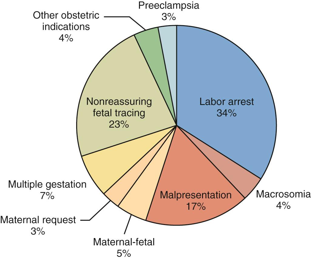 Fig. 19.1, Indications for Primary Cesarean Delivery.