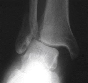 FIG. 62.1, (Courtesy Arthur Manoli)