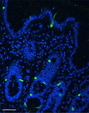 Fig. 28.2, Enteroendocrine L cells in human sigmoid colonic section. GLP-1 immunoreactivity in L cells scattered in the epithelial layer is indicated by the green fluorescence. The nuclei are stained with 4,6-diamidino-2-phenylindole, dihydrochloride (DAPI) ( blue ). Bar 50 μm.