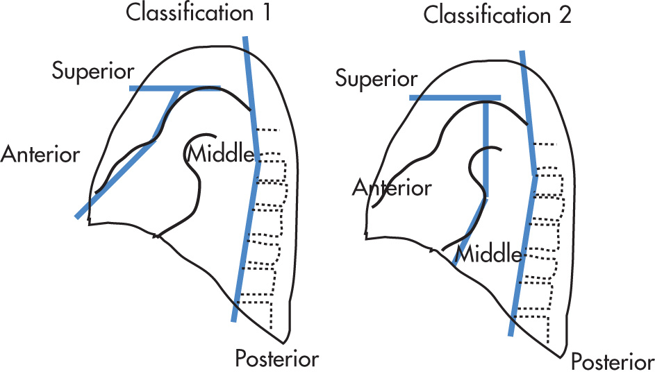 FIG. 1.14